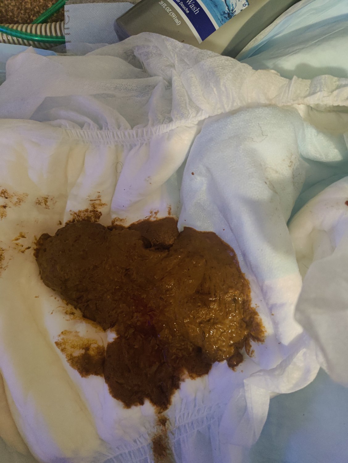 I wonder why people keep saying I'm full of Shit 💩 #mcqwBWGO